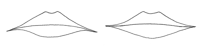 Le facelift mouth - Le facelift