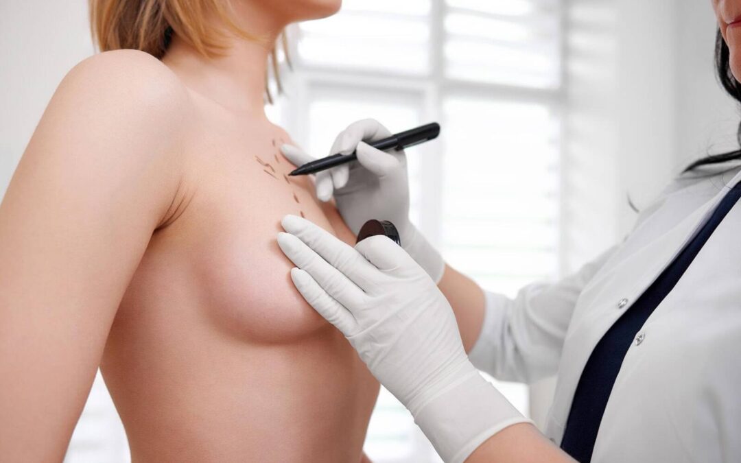 How much does breast augmentation cost in Quebec?